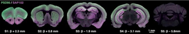 Подробная карта синапсов мозга приоткрыла завесу над загадкой мышления